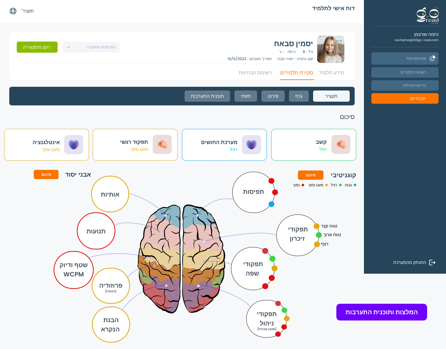דוח של המוח